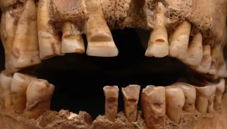 130 Viking iskeleti incelendi, şaşırtan bir gerçek daha ortaya çıktı
