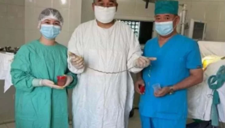 Tıp dünyası şokta! Kırgızistanlı çocuğun beyninden çıkan şaşırttı