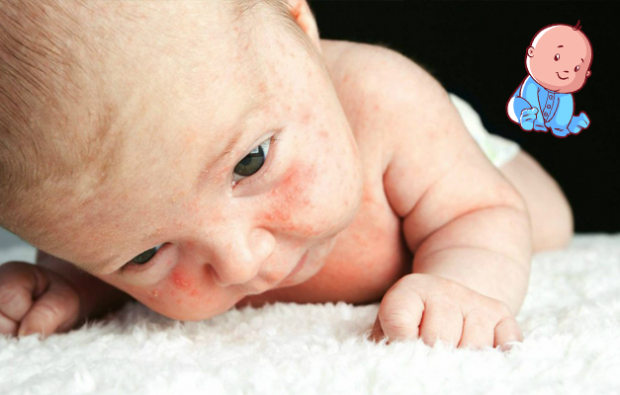 bebeklerde isilik neden olur bebeklerde isilige ne iyi gelir 2024 en iyi isilik kremleri CvBDZSk5