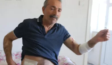Nevşehir’de ekmek almaya giderken köpeklerin saldırısına uğradı